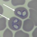 Hematozoários