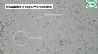 Urinálise como exame de triagem