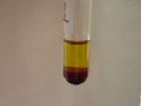 Interpretação dos bioquímicos